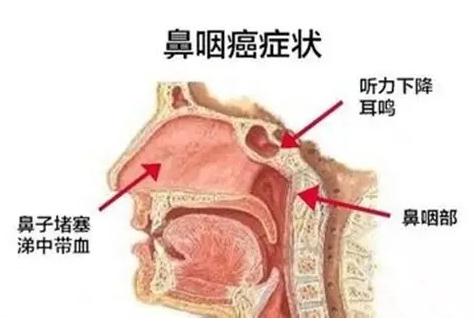 <b>���ʰ������Ʒ���</b>