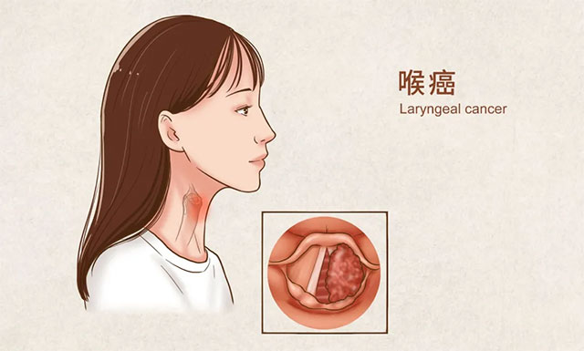 <b>˻ơʺеȲʳ Ҫ</b>